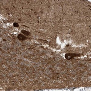 Anti-TRIM67 antibody produced in rabbit 
