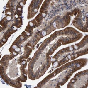 Anti-TRIM68 antibody produced in rabbit 