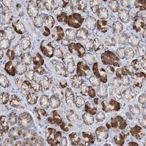 Anti-TRIM71 antibody produced in rabbit 