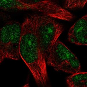 Anti-TRIM72 antibody produced in rabbit 