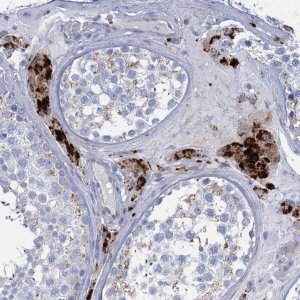 Anti-TRIM77 antibody produced in rabbit 