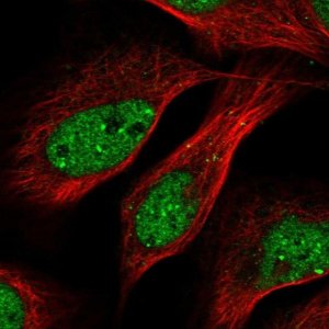 Anti-TRIP4 antibody produced in rabbit 