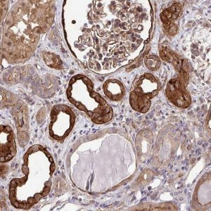 Anti-TRIP6 antibody produced in rabbit 