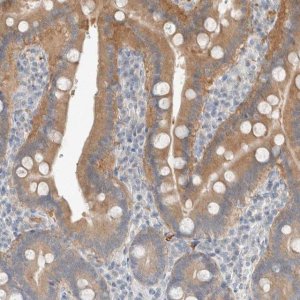 Anti-TRIT1 antibody produced in rabbit 