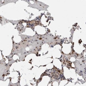 Anti-TRMT13 antibody produced in rabbit 
