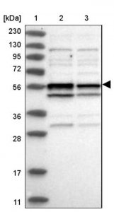 Anti-TRMT13 antibody produced in rabbit 