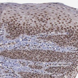 Anti-TRMT2A antibody produced in rabbit 
