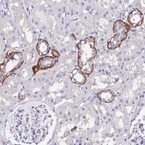 Anti-TRMT44 antibody produced in rabbit 