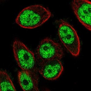 Anti-TRMT44 antibody produced in rabbit 