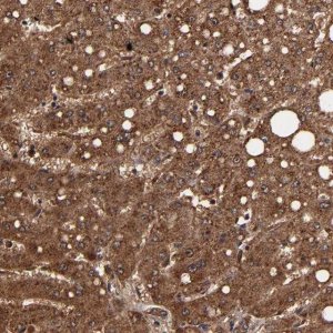 Anti-TROVE2 antibody produced in rabbit 