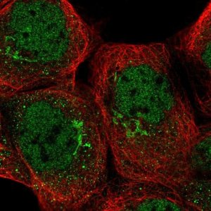 Anti-TRRAP antibody produced in rabbit 