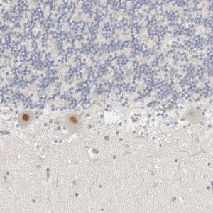 Anti-TSEN2 antibody produced in rabbit 