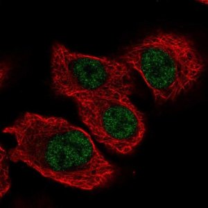 Anti-TSEN34 antibody produced in rabbit 