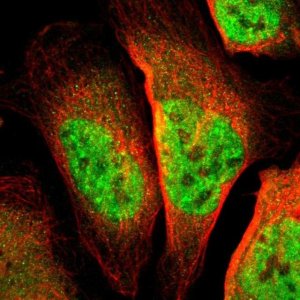 Anti-TSHZ1 antibody produced in rabbit HPA006982-100UL
