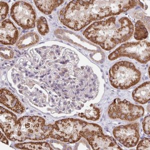 Anti-TSPAN31 antibody produced in rabbit 