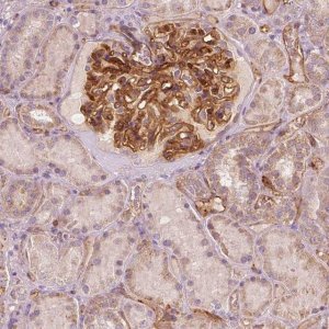 Anti-TSPO2 antibody produced in rabbit 