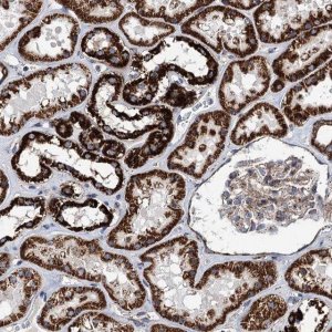 Anti-TSSK3 antibody produced in rabbit 