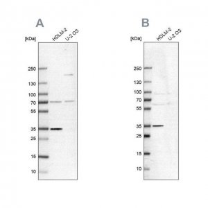 Anti-TTC19 antibody produced in rabbit 