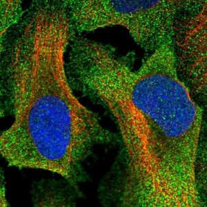 Anti-TTC23 antibody produced in rabbit 