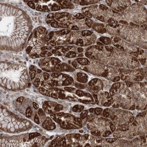 Anti-TTC37 antibody produced in rabbit 