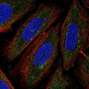 Anti-TTPAL antibody produced in rabbit 