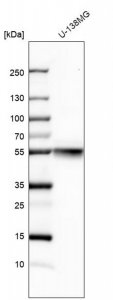 Anti-TUBB antibody produced in rabbit HPA046280-100UL