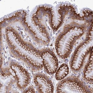 Anti-TUBGCP6 antibody produced in rabbit 