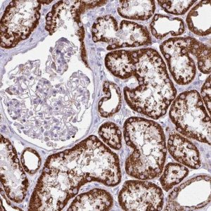Anti-TVP23A antibody produced in rabbit 