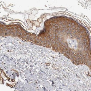 Anti-TYK2 antibody produced in rabbit 