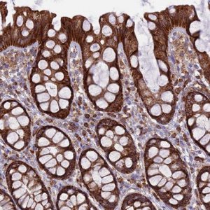 Anti-UAP1L1 antibody produced in rabbit 