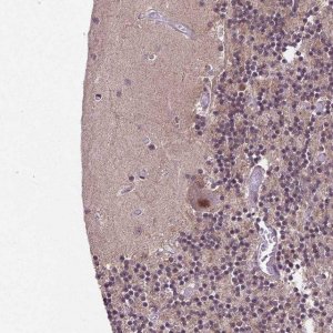 Anti-UBA3 antibody produced in rabbit HPA034874-100UL
