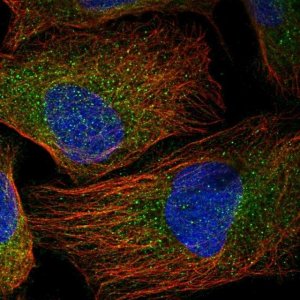 Anti-UBE2F antibody produced in rabbit HPA037444-100UL
