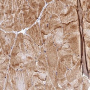Anti-UBE2G1 antibody produced in rabbit HPA050551-100UL