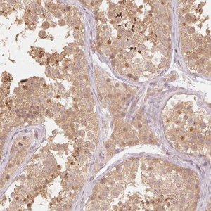 Anti-UBE2L3 antibody produced in rabbit 