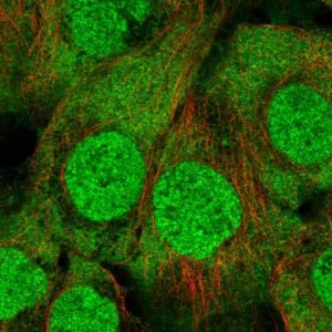 Anti-UBE2L3 antibody produced in rabbit 