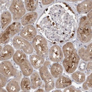Anti-UBE3D antibody produced in rabbit 