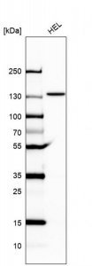 Anti-UBE4A antibody produced in rabbit HPA064010-100UL