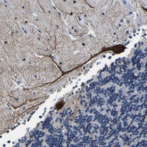 Anti-UBN2 antibody produced in rabbit 