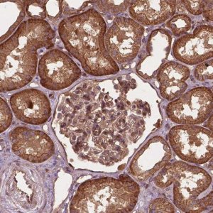 Anti-UBXN2A antibody produced in rabbit 