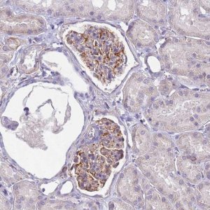 Anti-UBXN2B antibody produced in rabbit 
