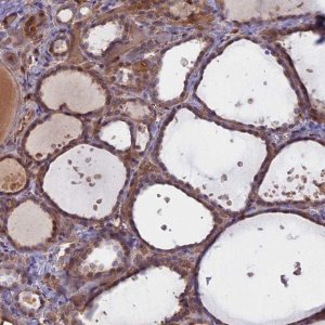 Anti-UFSP2 antibody produced in rabbit 