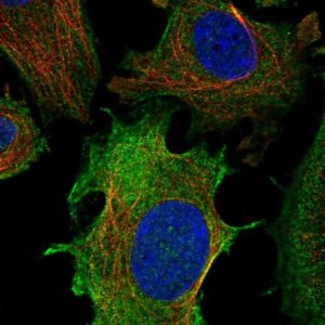 Anti-ULBP1 antibody produced in rabbit 