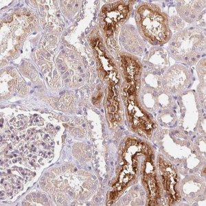Anti-UNC13B antibody produced in rabbit 