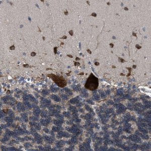 Anti-UPF1 antibody produced in rabbit 