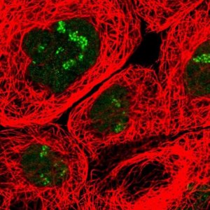 Anti-URB1 antibody produced in rabbit 