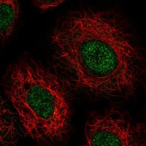 Anti-USB1 antibody produced in rabbit 