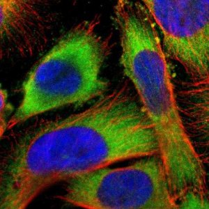 Anti-USP14 antibody produced in rabbit 
