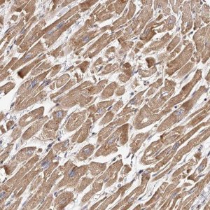 Anti-USP21 antibody produced in rabbit 