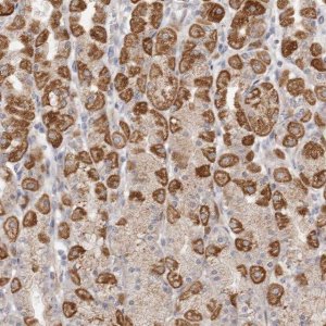 Anti-USP24 antibody produced in rabbit HPA028428-100UL