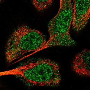 Anti-USP24 antibody produced in rabbit HPA028428-100UL